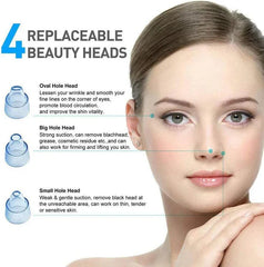 Blackhead Remover Vacuum – Rechargeable Pore Cleaner for All Skin Types